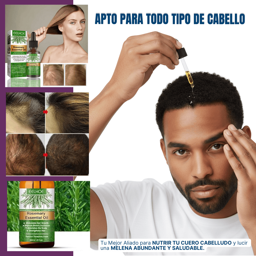 Aceite de Romero | ¡Despídete de la caída del cabello!