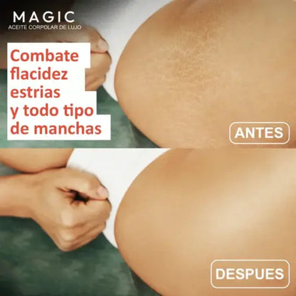 Aceite Corporal Magic™ | Nutre e ilumina tu piel 🔥Super Promo 2x1🔥